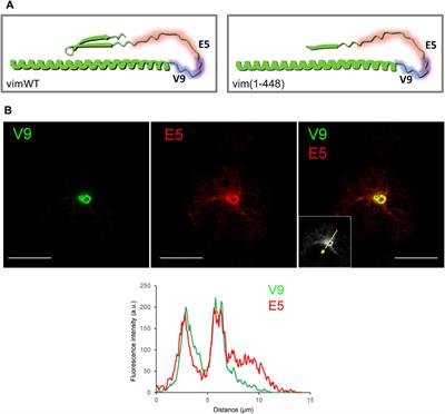 Vimentin Tail Segments Are Differentially Exposed at Distinct Cellular Locations and in Response to Stress